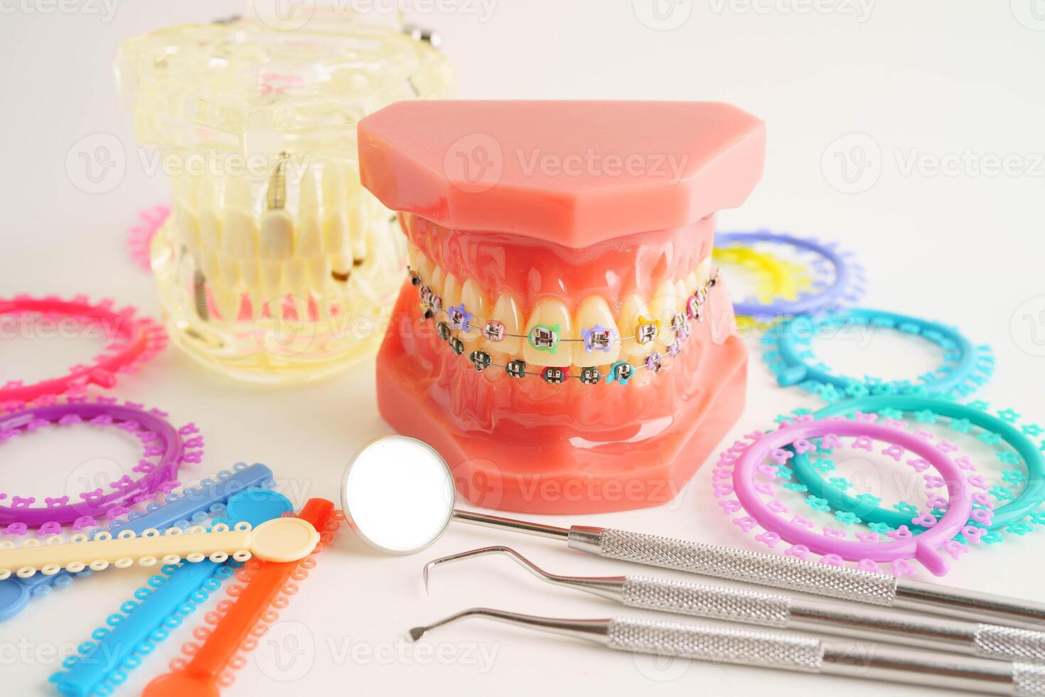Orthodontic ligatures rings and ties, elastic rubber bands on orthodontic braces, model for dentist studying about photo