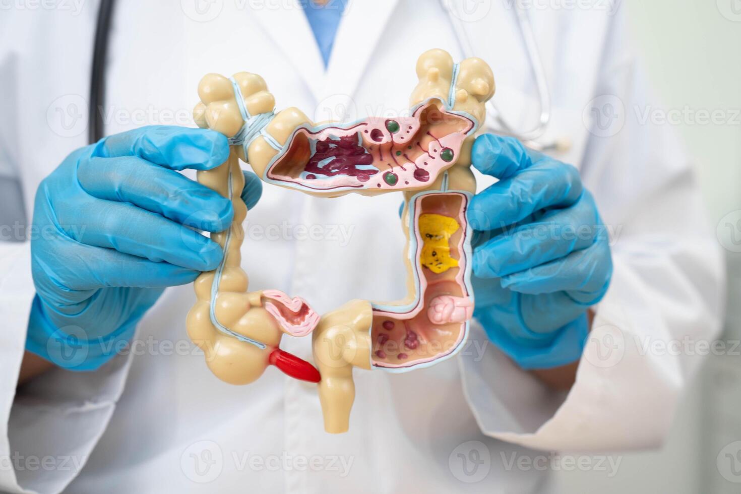 Intestine, doctor holding human anatomy model for study diagnosis and treatment photo