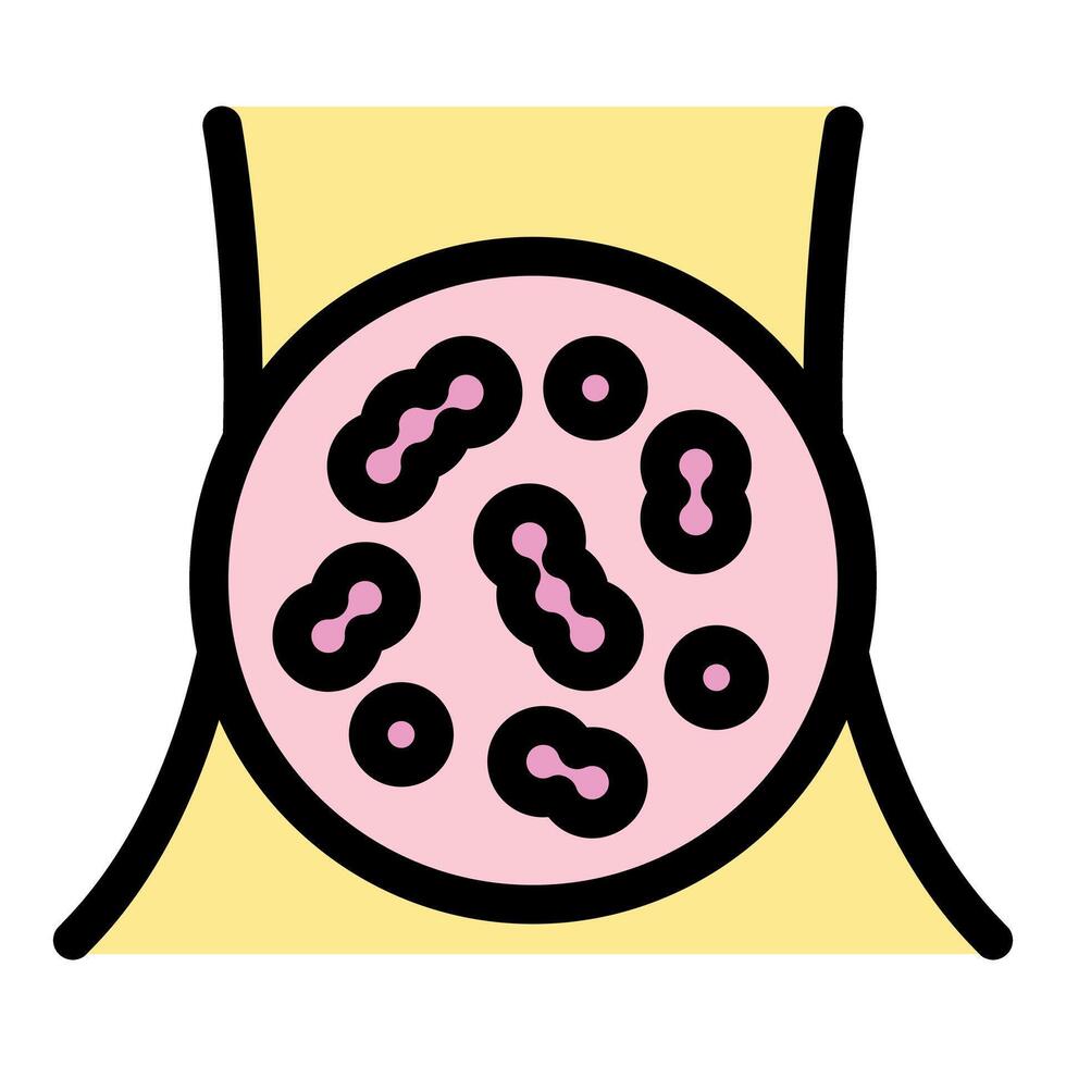 Bacteria colonizing human belly button creating infection vector