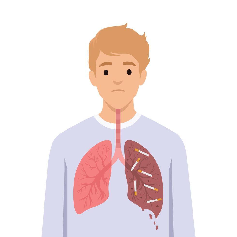 Comparation healthy lung to a damaged lung filled with cigarettes, harmful effects of smoking. vector