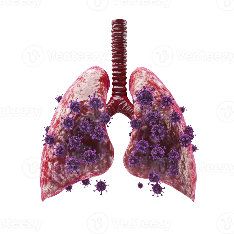 Lungs Infected With Numerous Viruses A Medical Illustration png