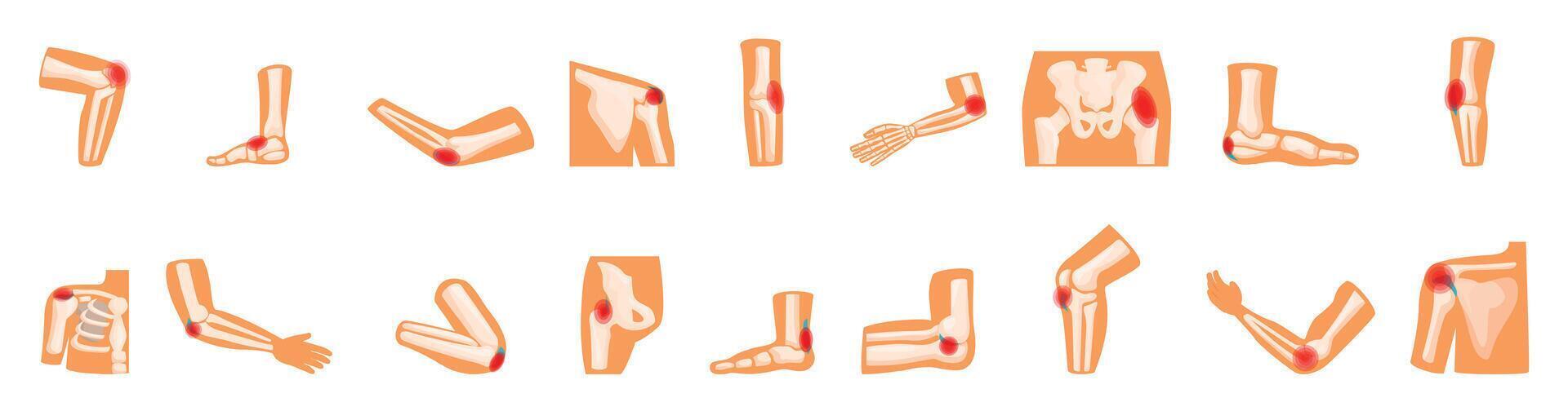 Bursitis icons set. Joint pain showing different body parts experiencing discomfort vector