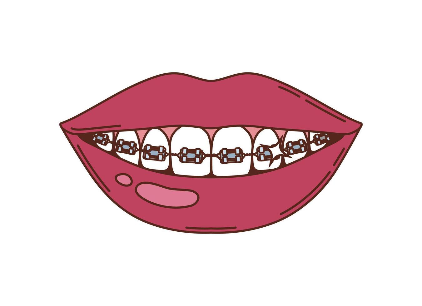 Cartoon groovy smiling lips with teeth with braces vector