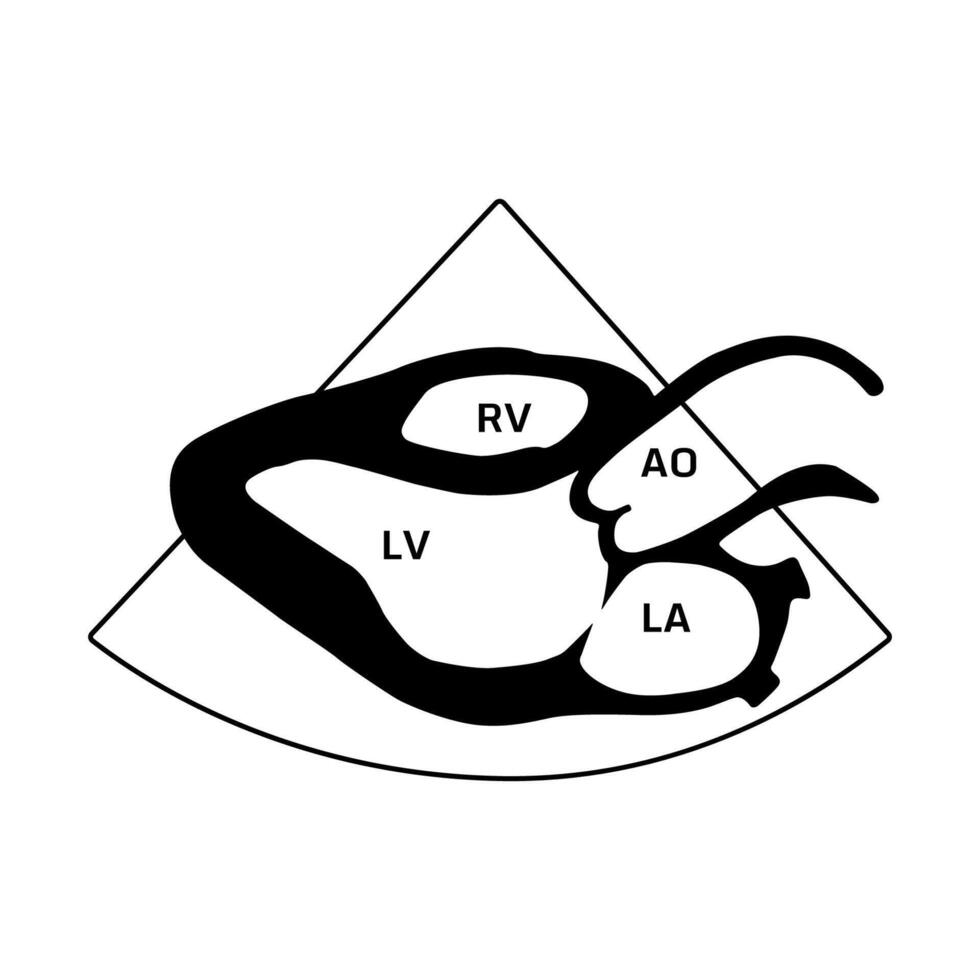 Parasternal long axis view, heart disease vector