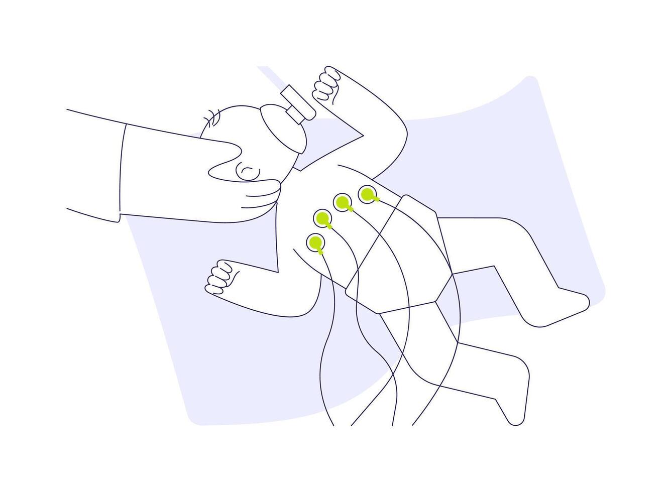 Neonatal surgery abstract concept illustration. vector