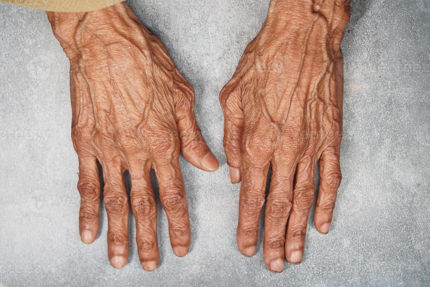 Weathered hands of an elderly person resting on a surface photo