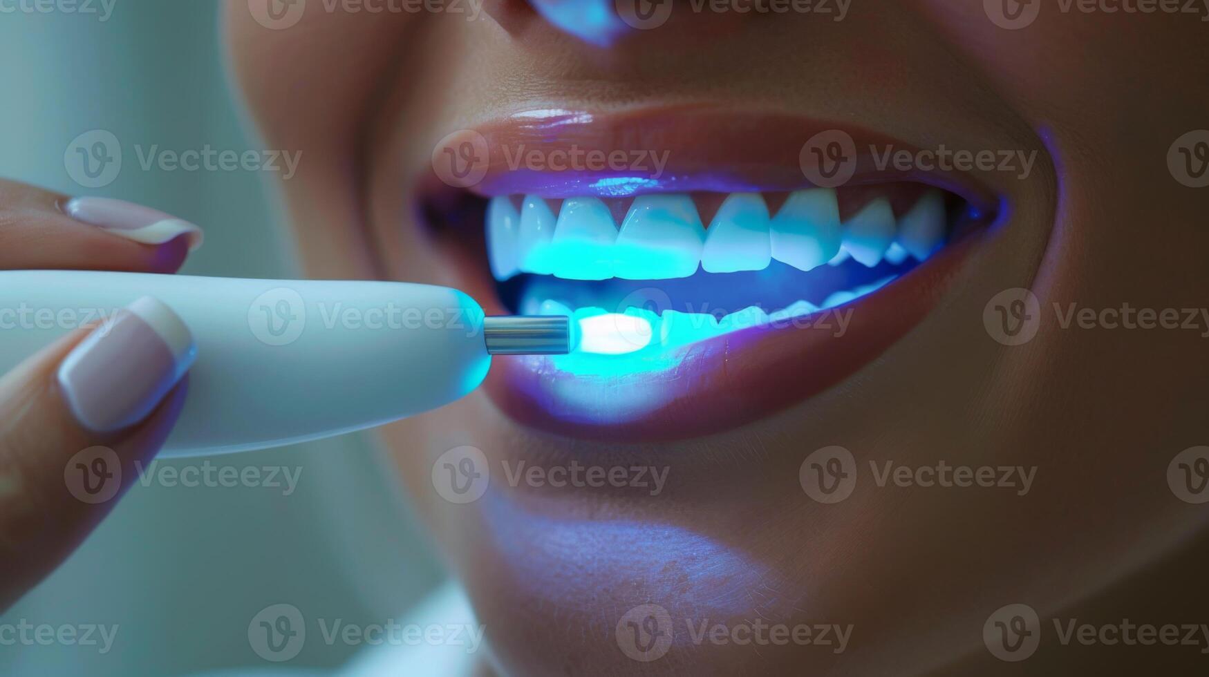 A person undergoing a teeth whitening procedure using a handheld device that emits blue light to enhance brightness at a dental clinic, showcasing a focus on dental care and aesthetics. photo