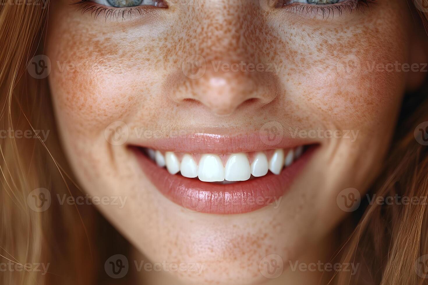 Close-Up of Freckled Woman Smiling with Bright White Teeth - Beauty and Happiness Concept photo