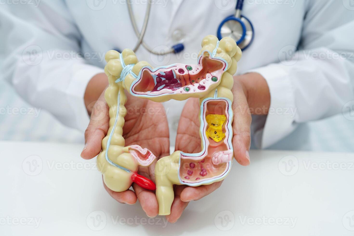 Intestine, doctor holding human anatomy model for study diagnosis and treatment in photo