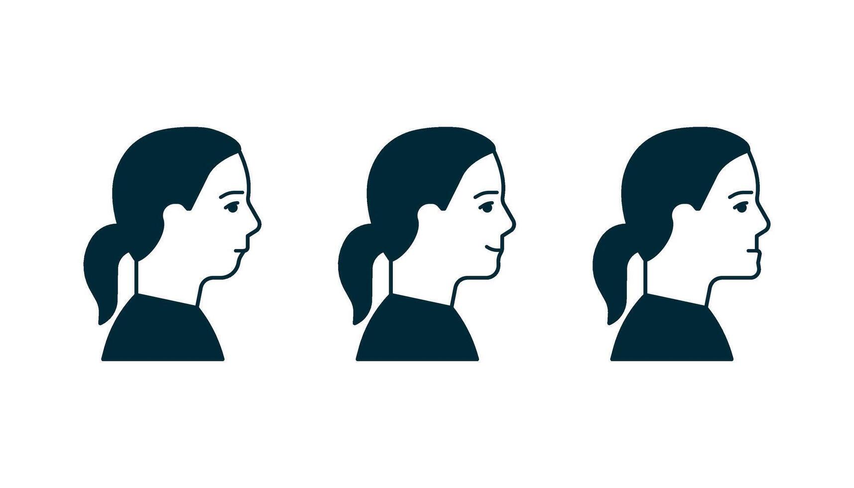 Bite normal jaw and malocclusion, face woman in profile set. Dental problem. Wrong bite, lower jaw extended forward and retracted. Bite correction. illustration vector