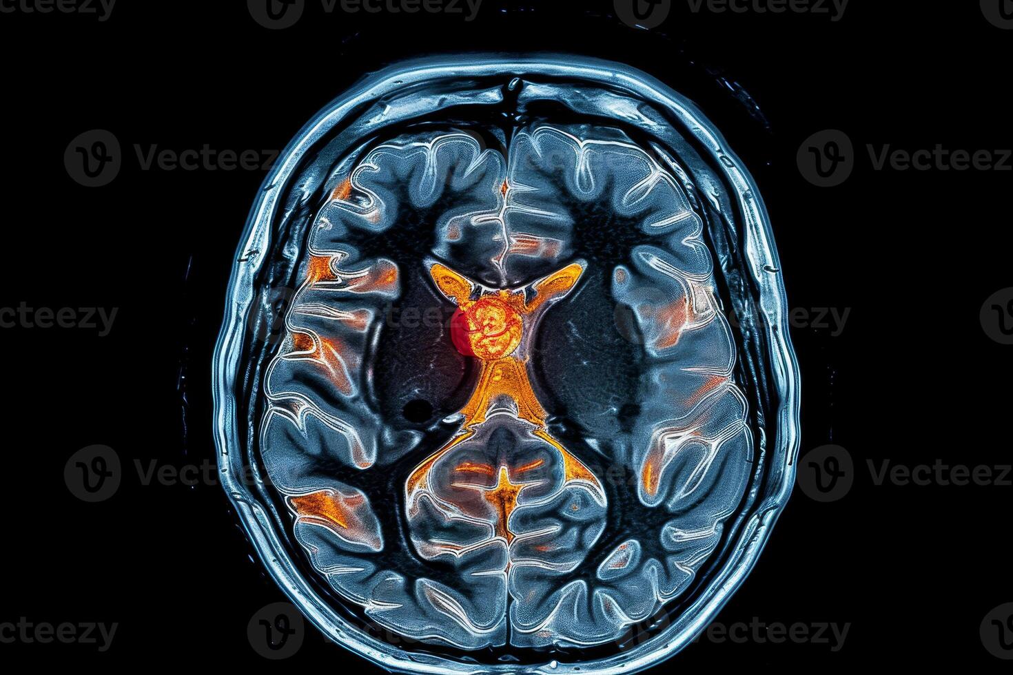 A brain MRI scan showcases intricate structures, with colored regions indicating active areas, offering insights into neurological functioning and health photo
