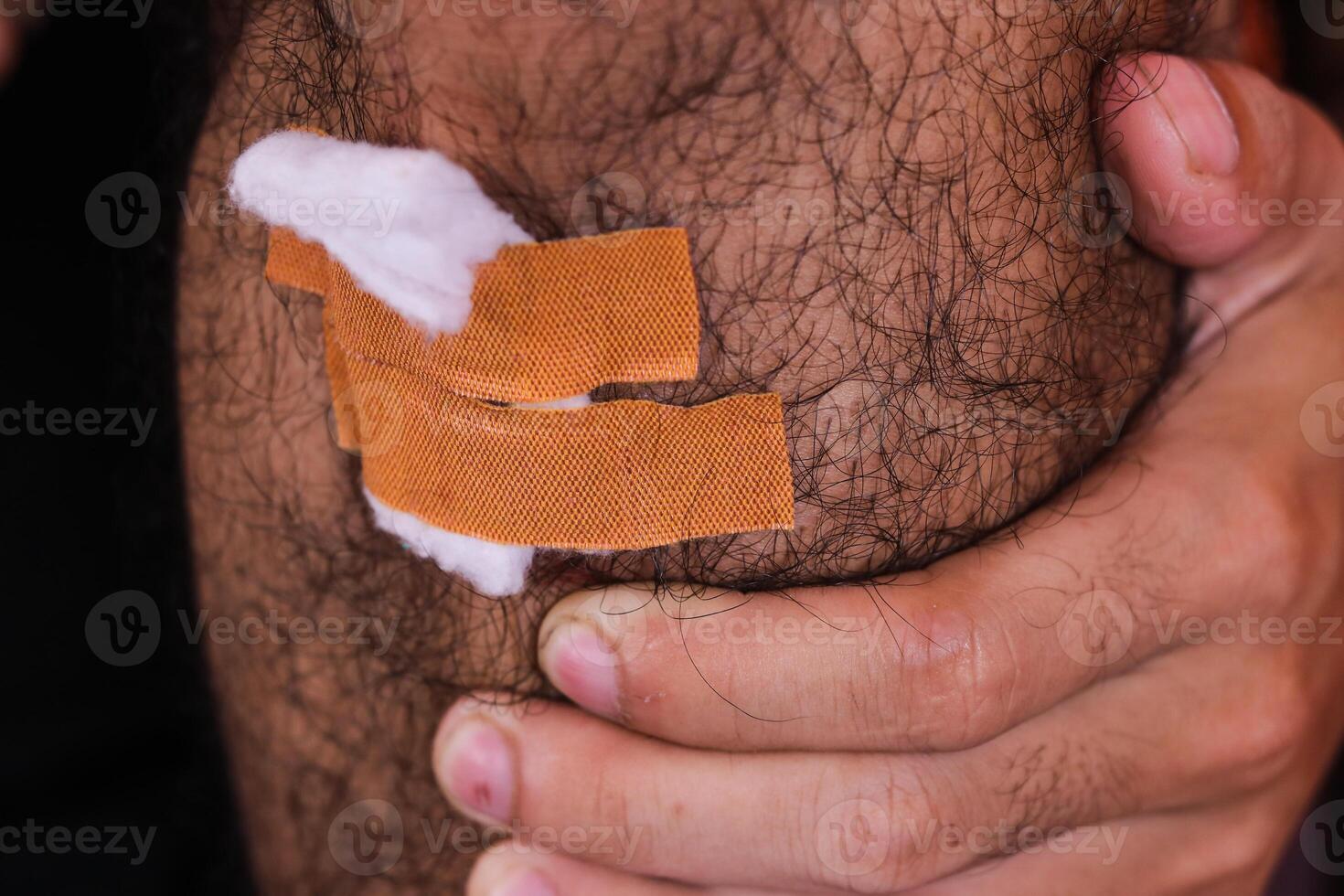 A close up image of a hairy leg with a gauze pad and two band-aids covering the wound, concept of wound care and self treatment. photo