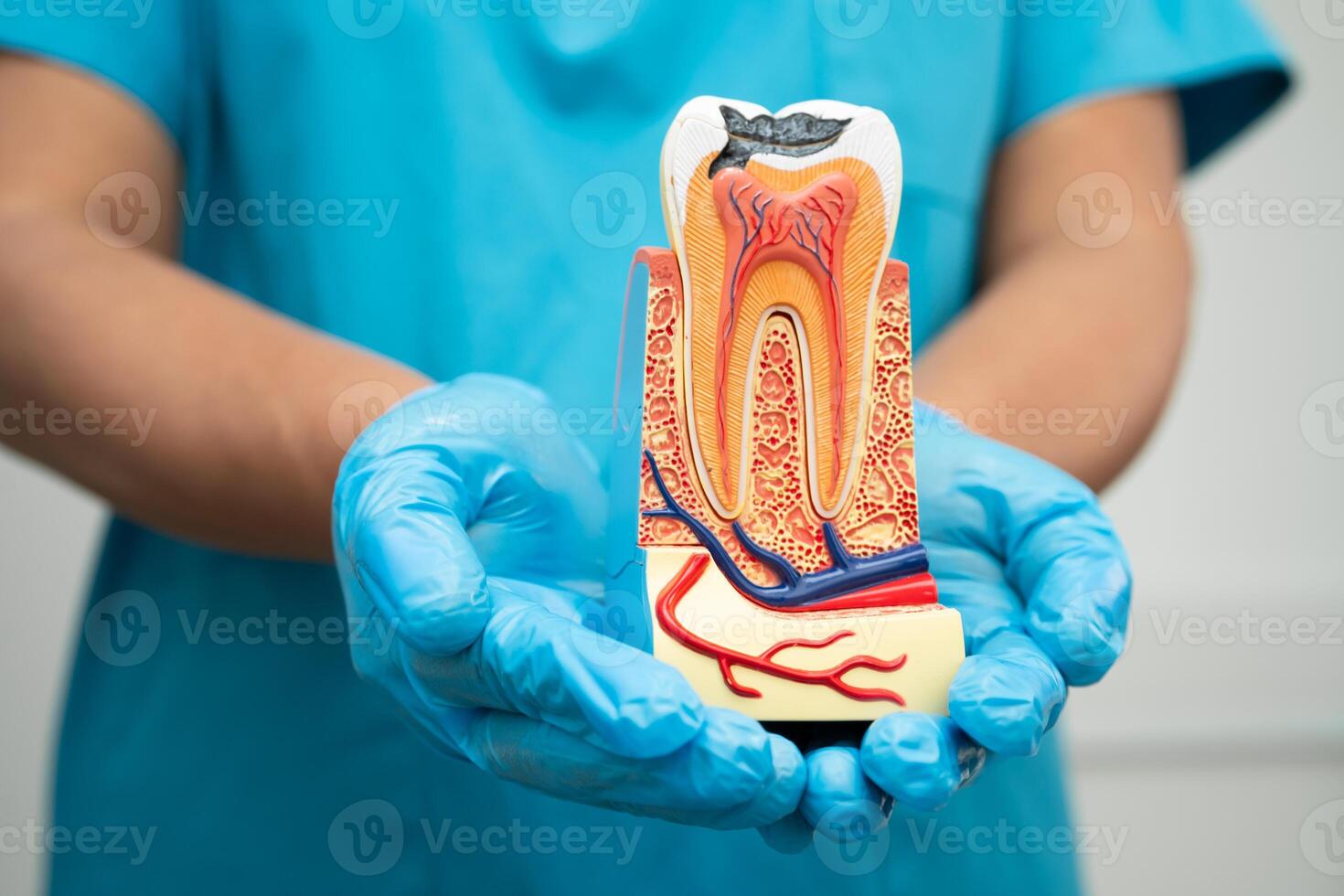Asian dentist holding dental implant, artificial tooth roots into jaw, root canal of dental treatment photo