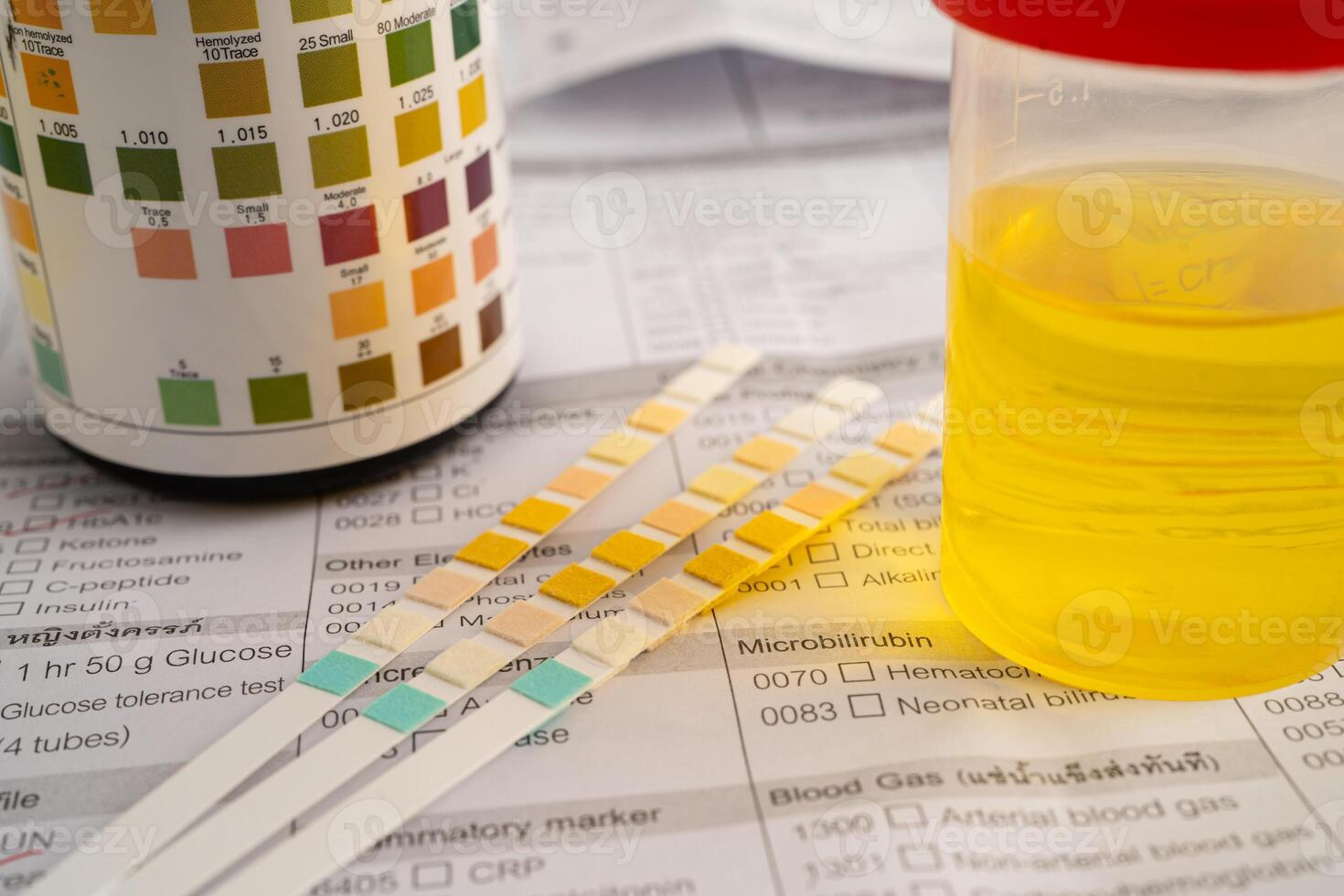 Urinalysis, urine cup with reagent strip pH paper test and comparison photo