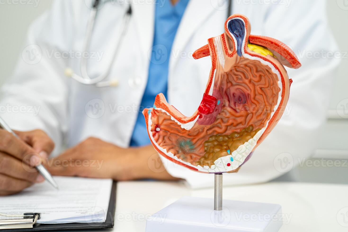 Stomach disease, doctor with human anatomy model photo