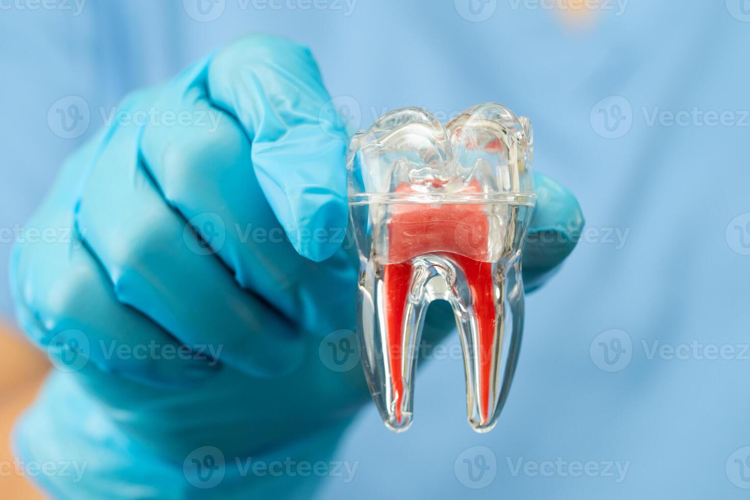 Asian dentist holding dental implant, artificial tooth roots into jaw, root canal of dental treatment, gum disease photo