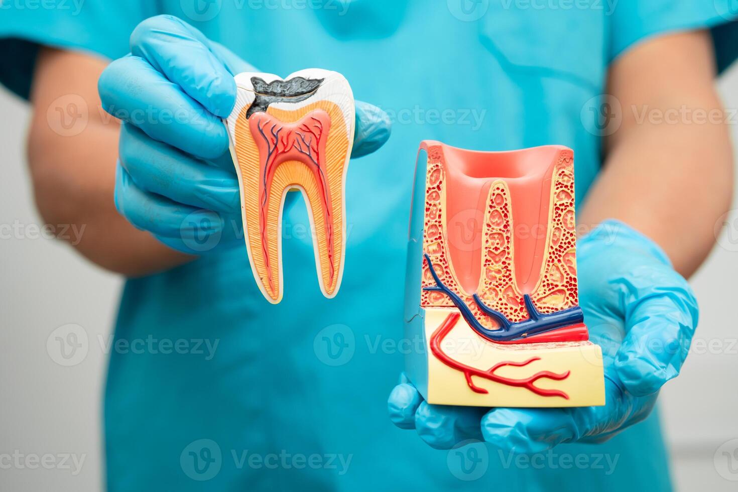 Asian dentist holding dental implant, artificial tooth roots into jaw, root canal of dental treatment, photo
