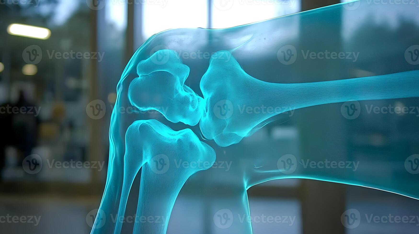 A 3d image of a knee joint photo