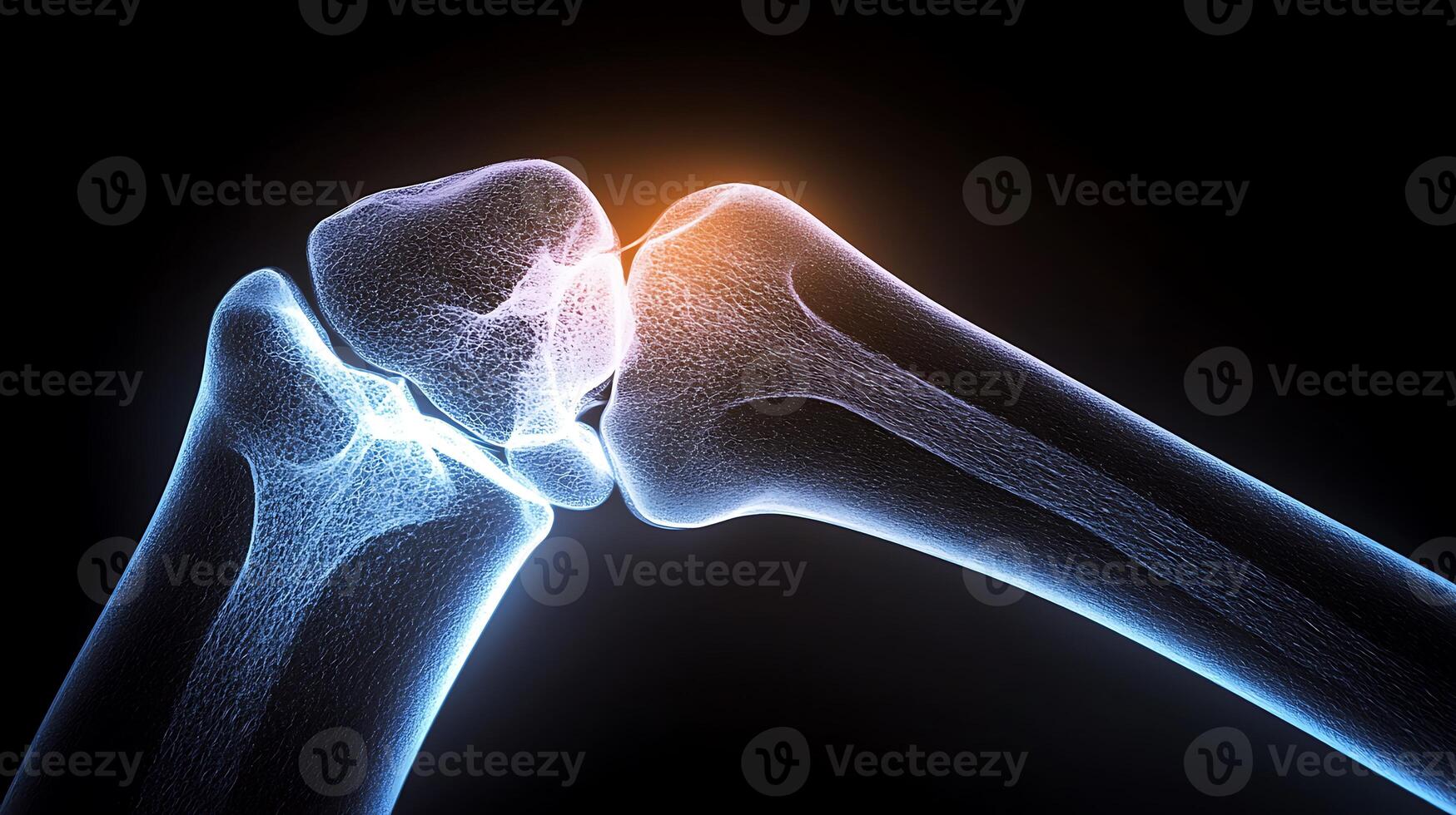 A knee joint with a bone in it photo