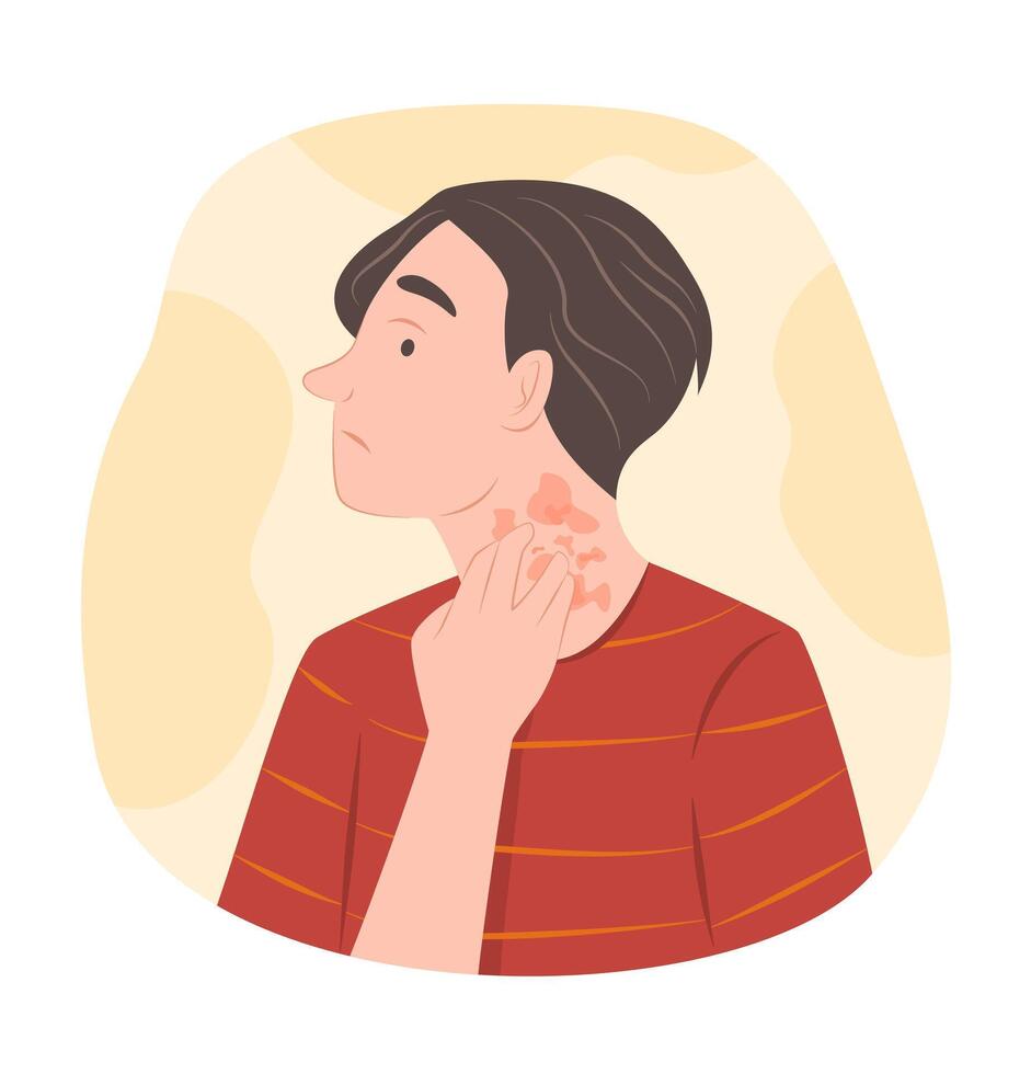 Worried Man with Atopic Dermatitis or Eczema on Her Neck for Dermatology Concept Illustration vector