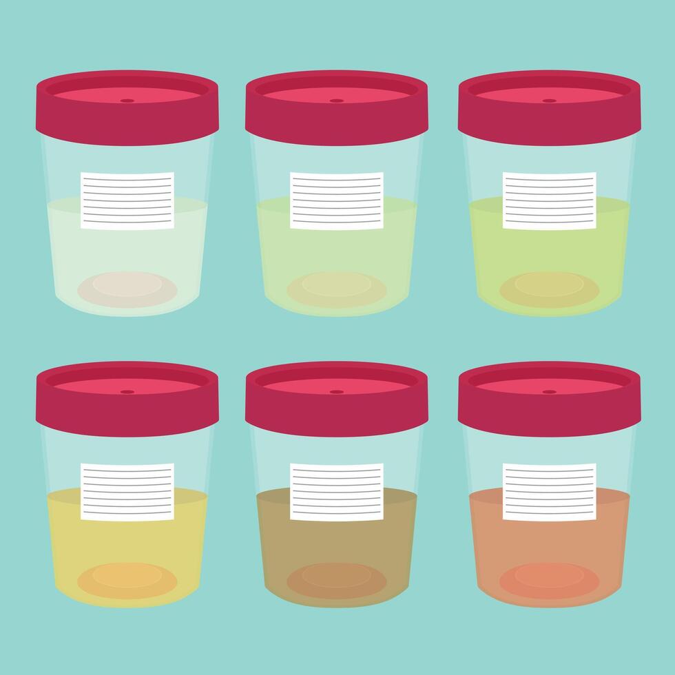 Urine test color chart vector
