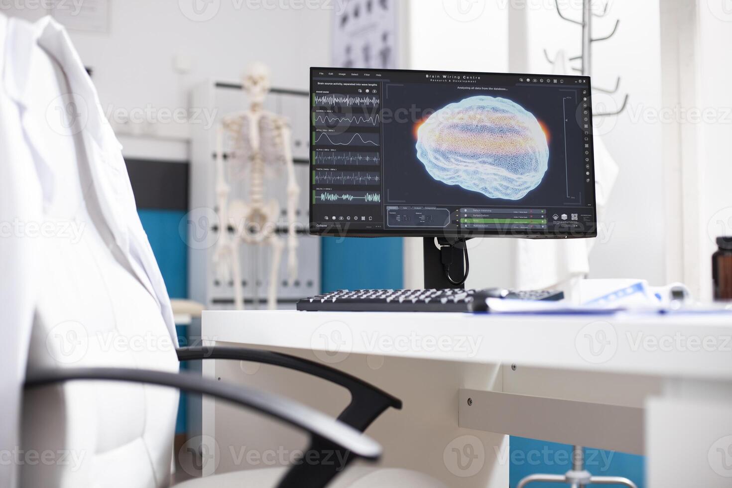 Unoccupied desk with computer screen displaying brain imaging data in doctors office. Modern pc monitor showing radiology results of human head highlighting use of advanced technology in hospital. photo