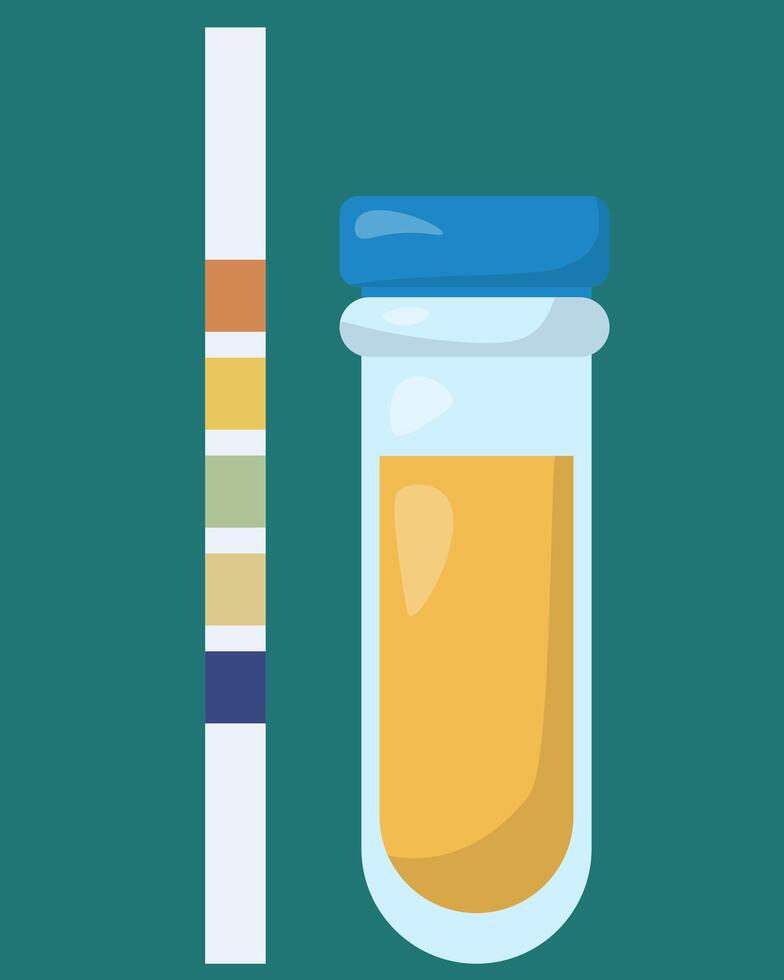 Acetone test, paper strip with colored squares for acetone level analysis and closed test tube with urine sample vector