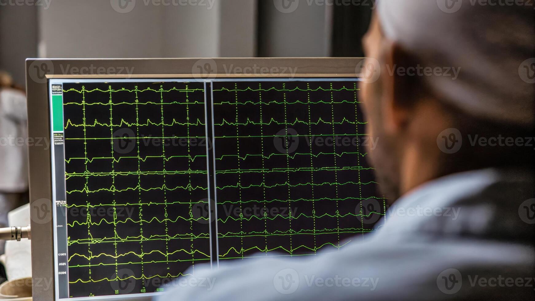 A technician observing a monitor filled with EEG data showcasing electrical patterns in the brain as they prepare to initiate a brain modulation session.. photo