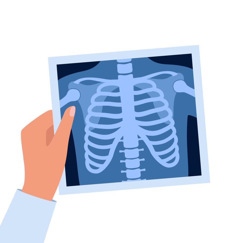 Xray of human skeleton chest and pelvis human bones. Roentgen shot in doctors hand. Medical analyzing. Anatomical bone medicine laboratory radial scan. . vector