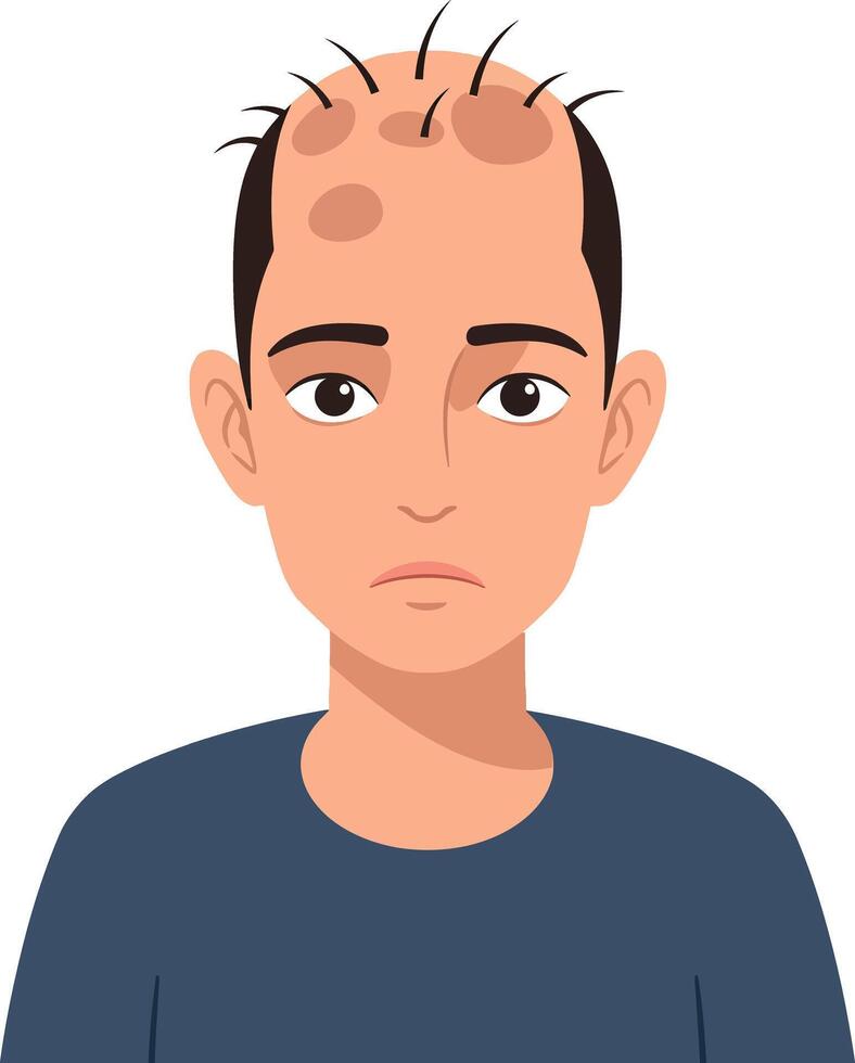 A sad young man with thinning hair and a blue shirt in a minimal flat design illustration expressing concern and vulnerability in a simple style vector