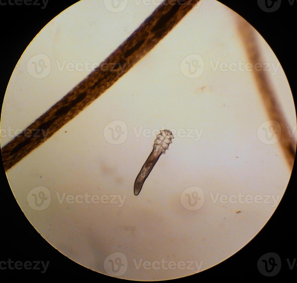 Demodex folliculorum - parasitic mite on the eyelashes of a human eye photo