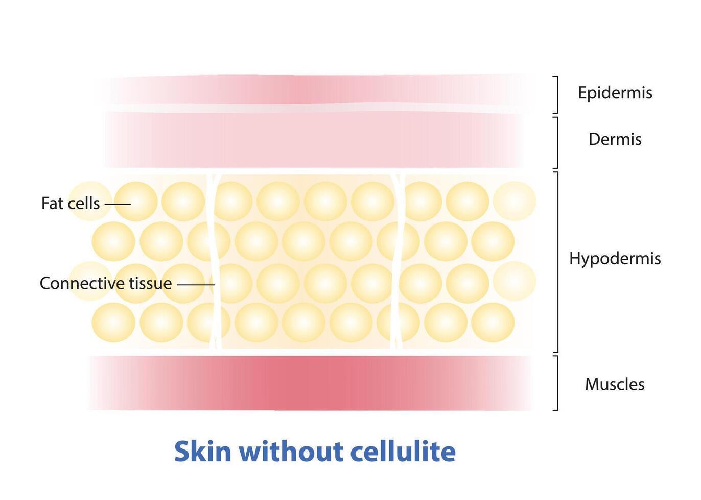 Formation of skin without cellulite illustration isolated on white background. Cross section of skin smooth without cellulite, fatty deposits and regular texture. Skin care and beauty concept. vector