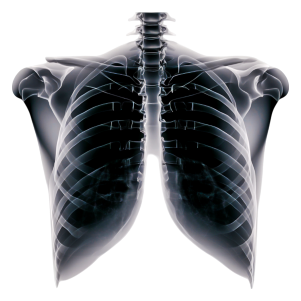 Human Chest X-Ray Showing Rib Structure and Lungs in Detail png