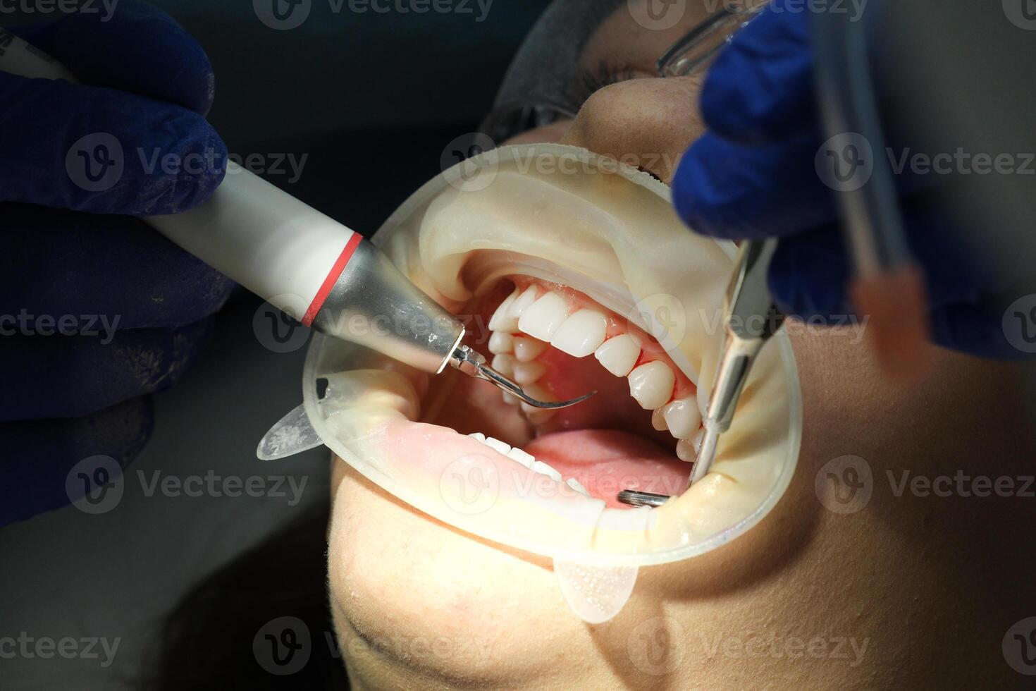 Dental assistant, Dental tools, Tooth check. Dentist in blue scrubs is examining patient's teeth with help from dental assistant in red scrubs. photo