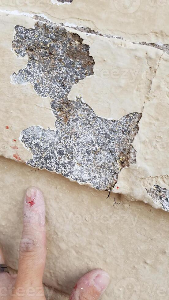 Scraped Finger on Left Hand while Remodeling a Brick House photo