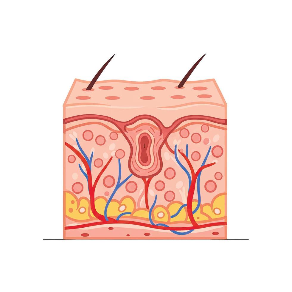 The skin is shown with a diagram of the different layers vector
