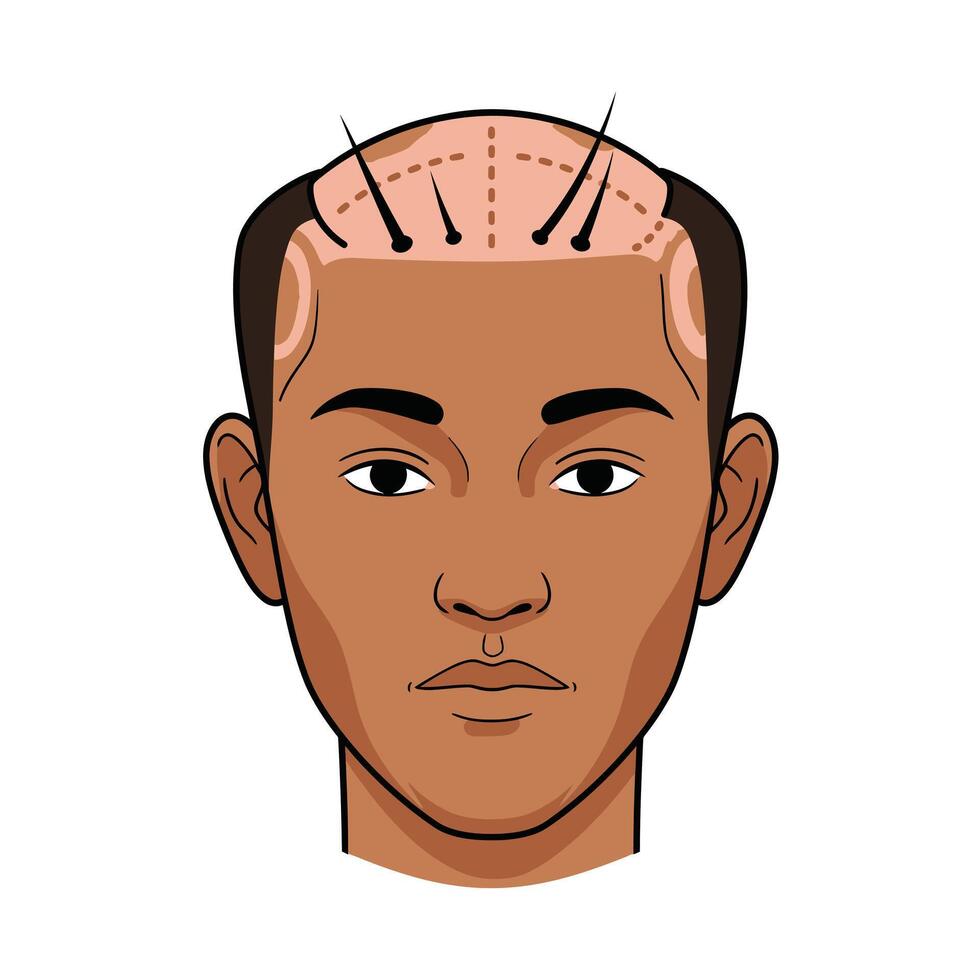A man with a shaved head and a bald spot vector