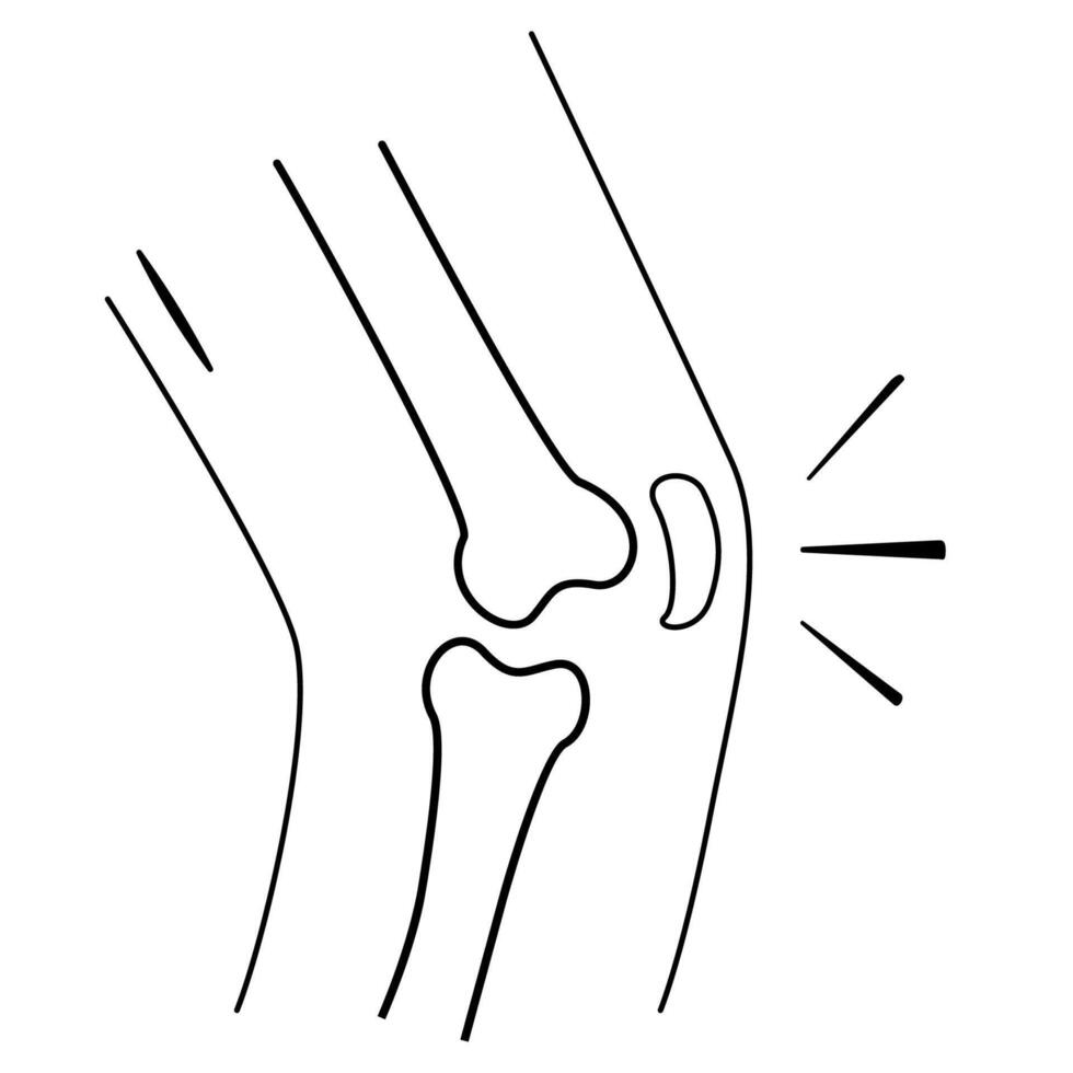 osteoarthritis deformity black outline drawing vector