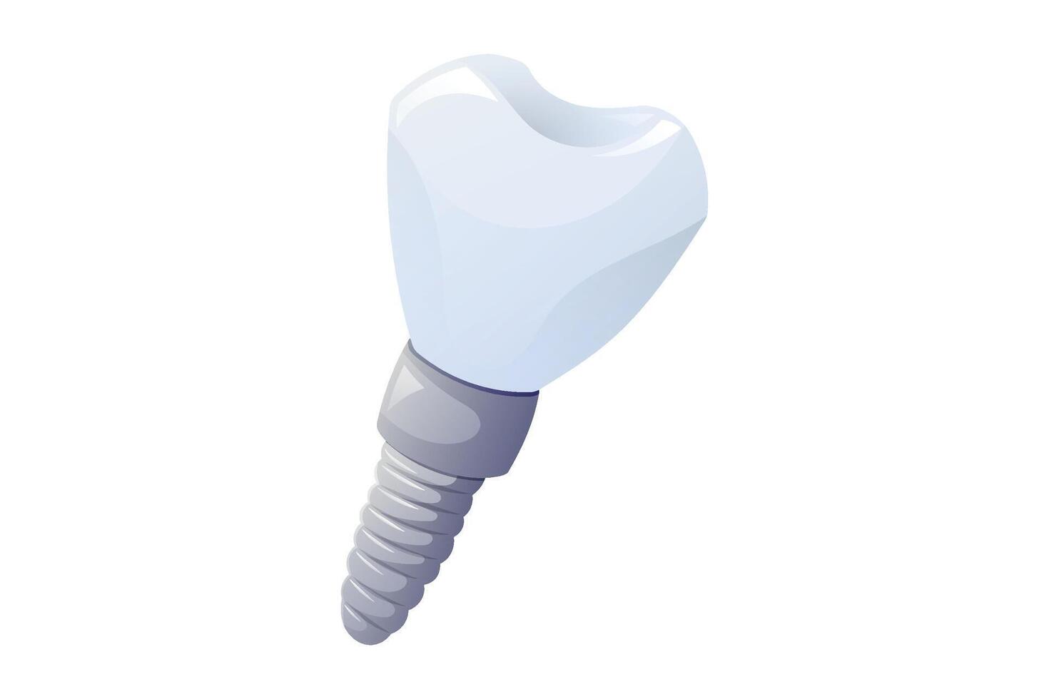Dental cartoon implant with titanium screw and white ceramic crown, isolated illustration on white background. Realistic tooth restoration concept for prosthetics, oral surgery, and dentistry. vector