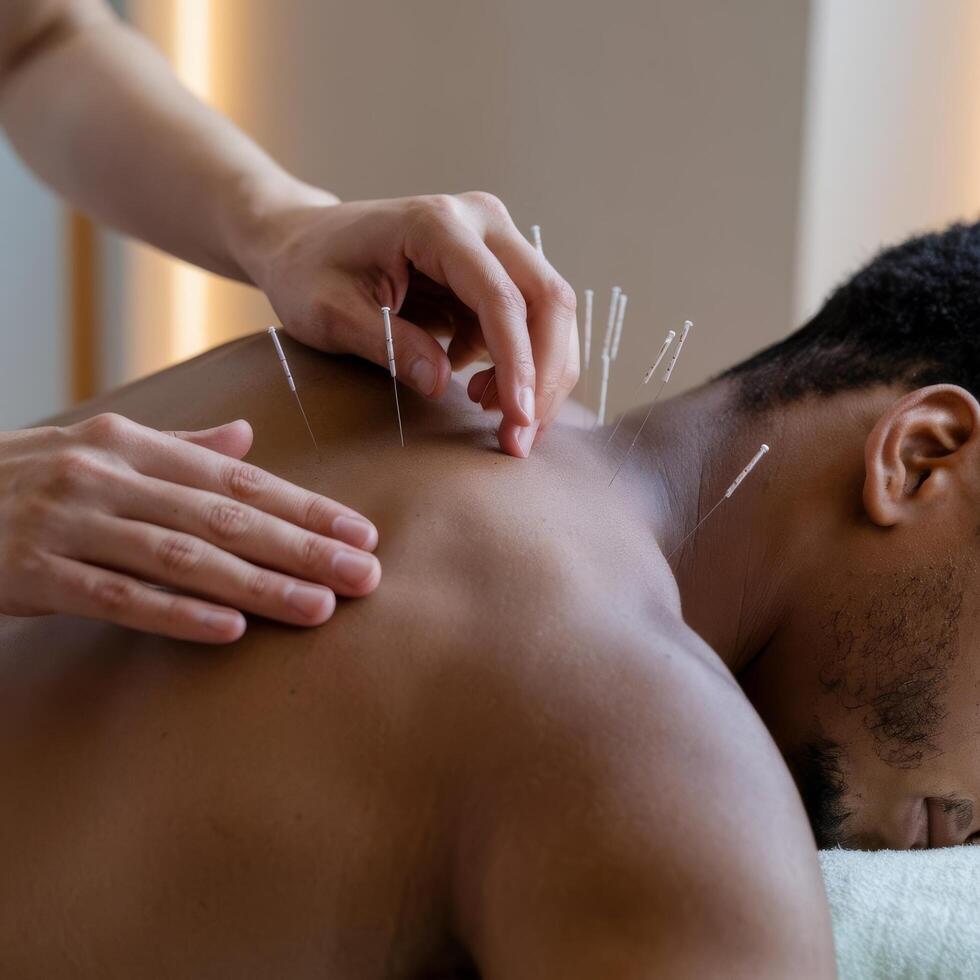 Acupuncture therapy on back spine shoulders for black male client closeup part of body photo