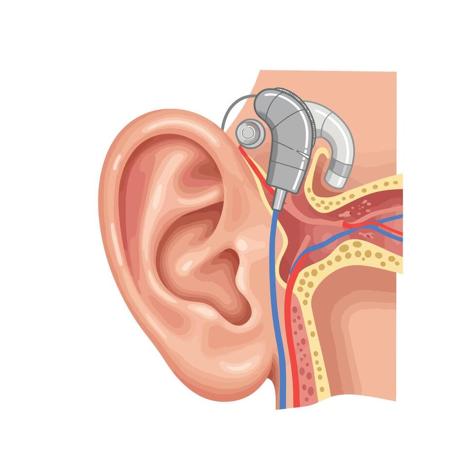 An ear with a hearing aid and a microphone vector