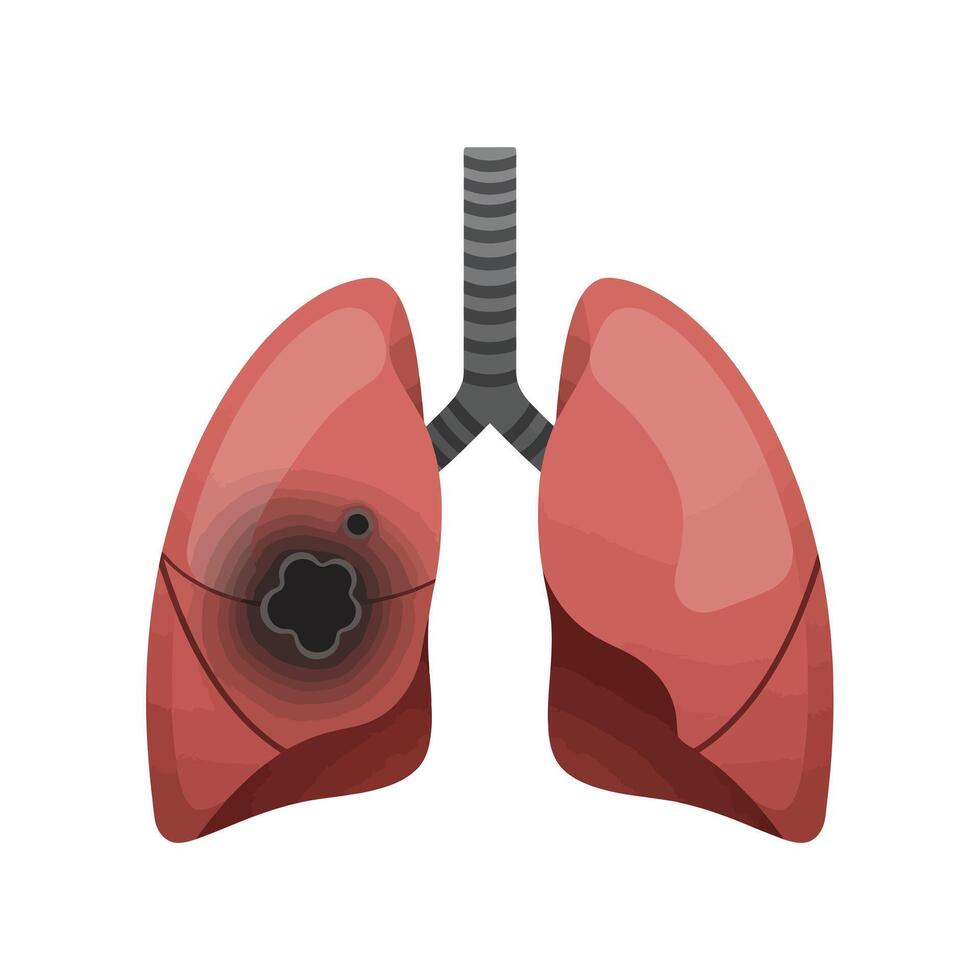 Lungs with a black spot on the left side vector