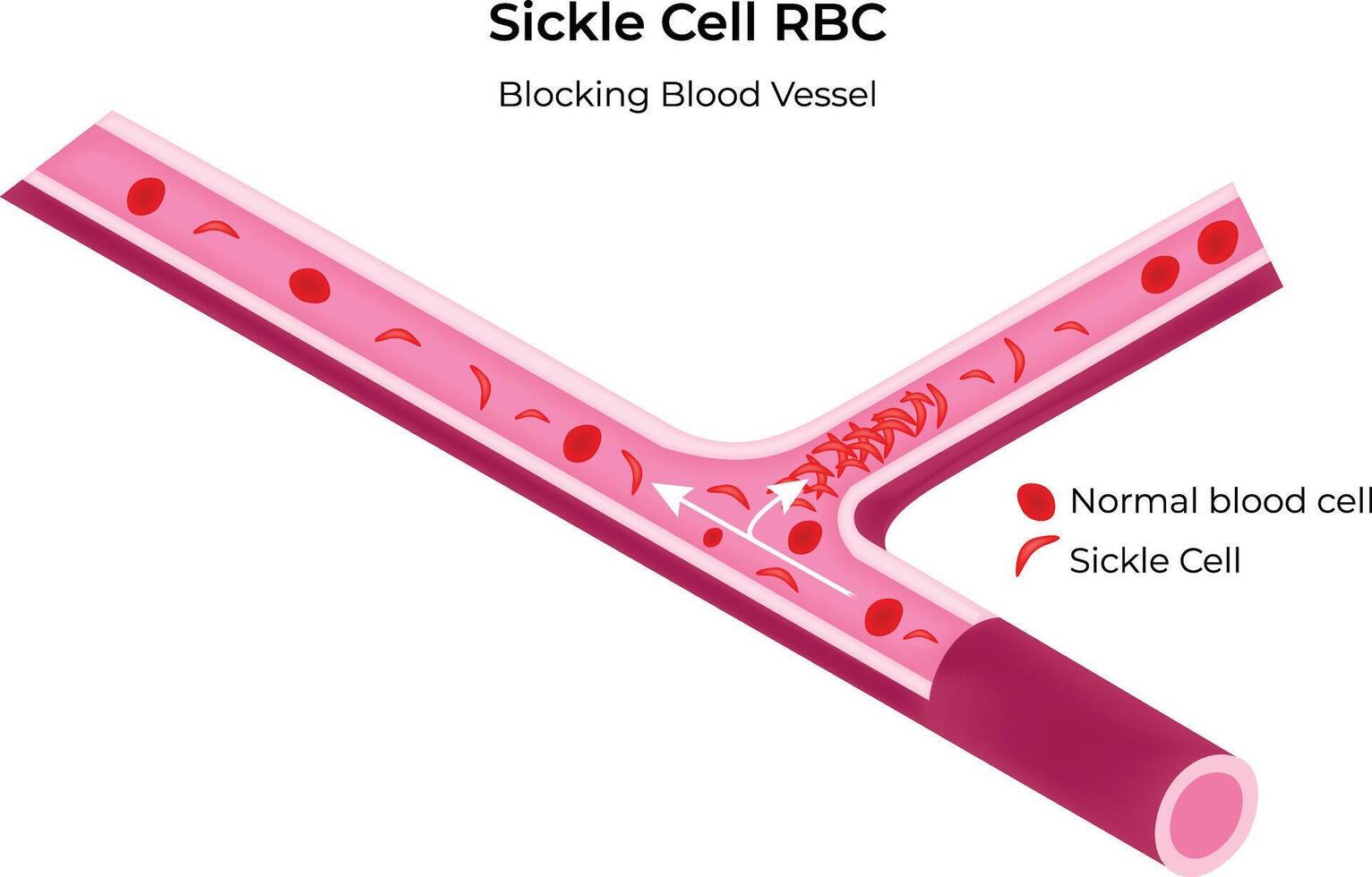 Sickle Cell RBC Science Design Illustration Diagram vector