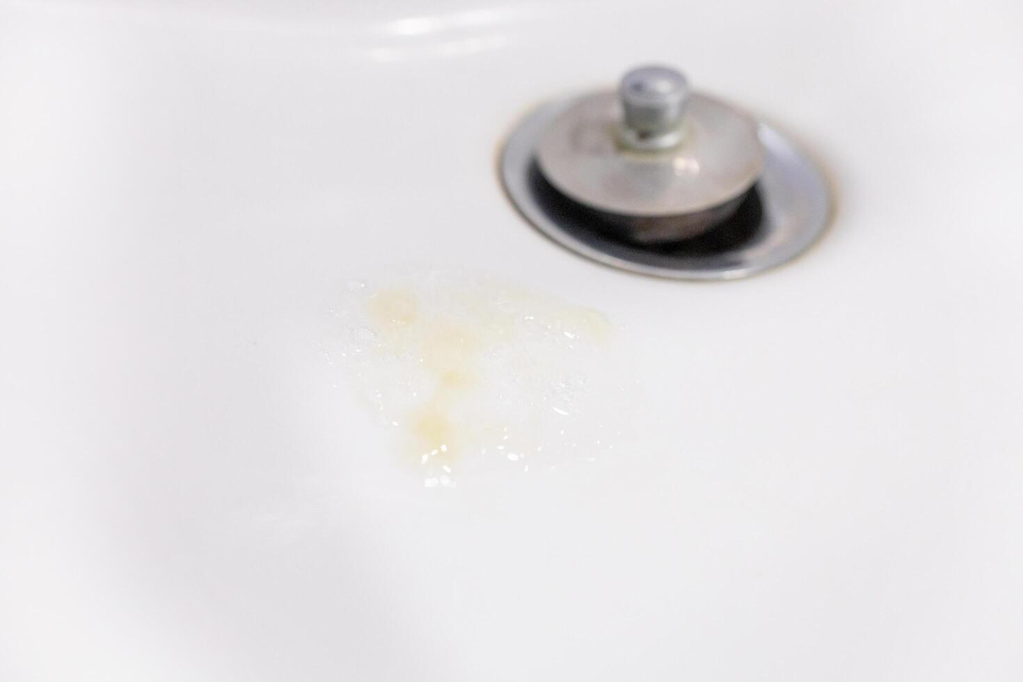 Phlegm or Virus in washbasin photo