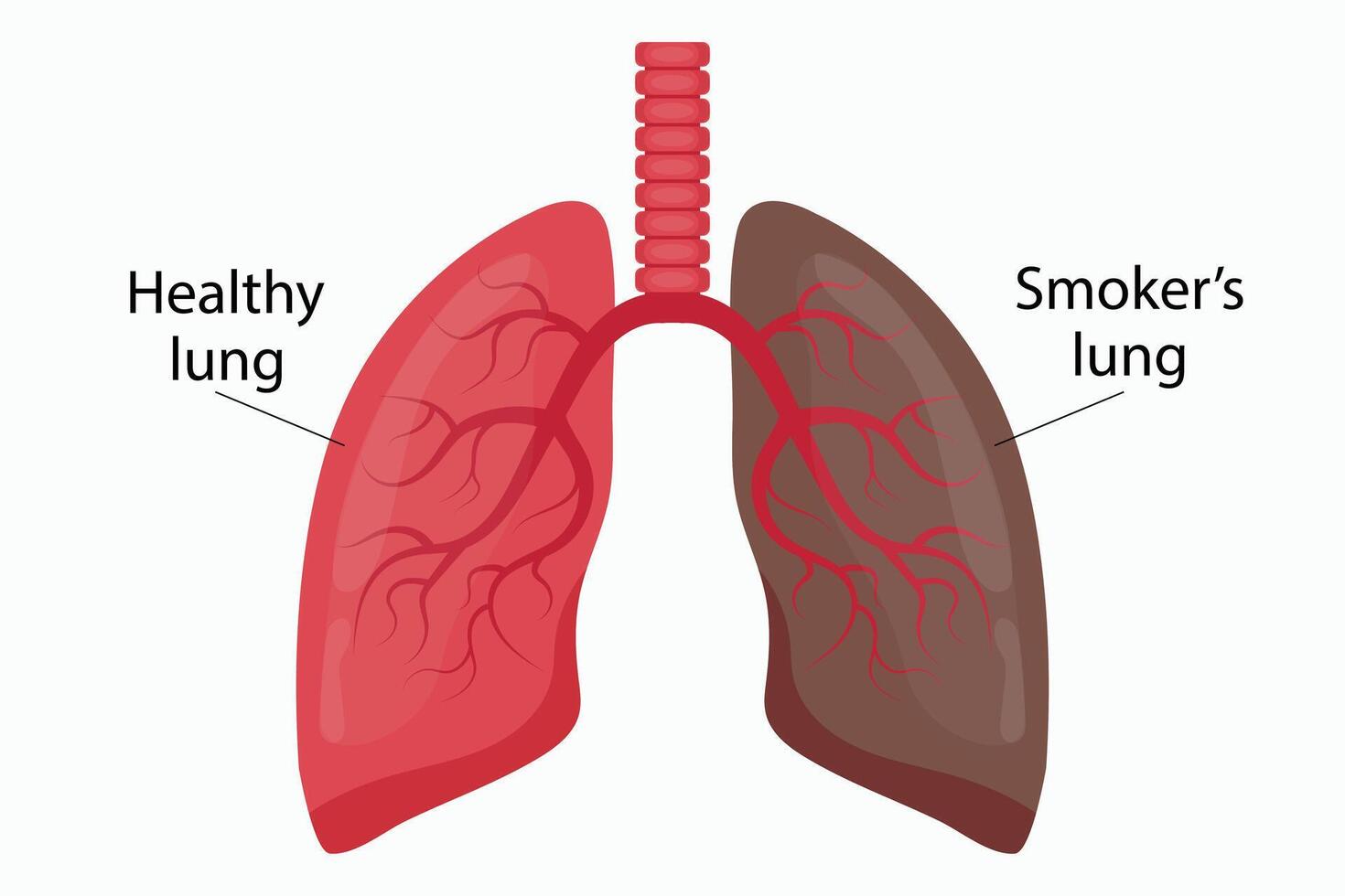 Illustration of healthy lung and smoker's lung. vector