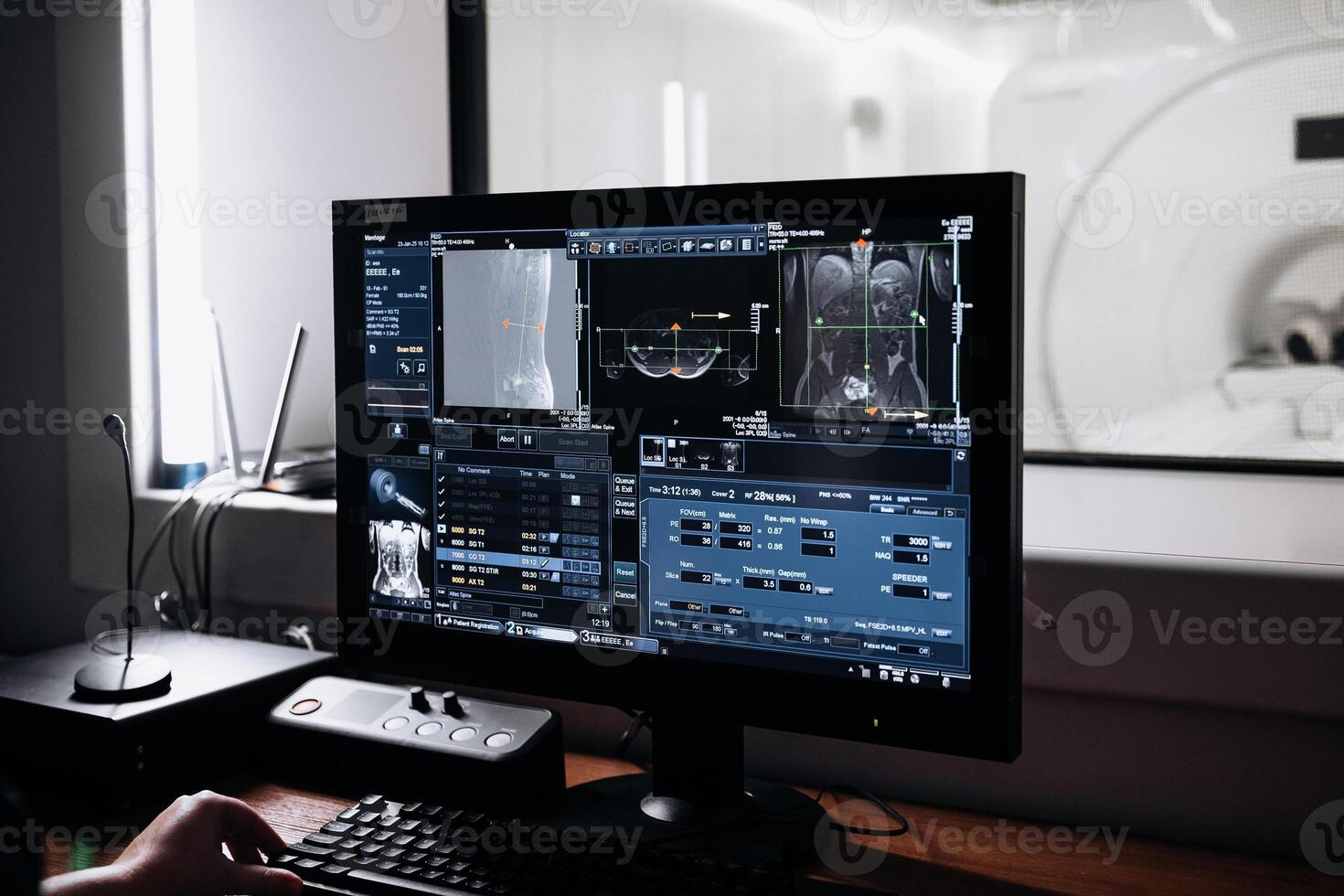 Medical Research Center. Neurologist, Neuroscientist, Neurosurgeon, Looks at TV Screen with Lungs MRI Scan Images, Thinks about Sick Patient Treatment Method photo