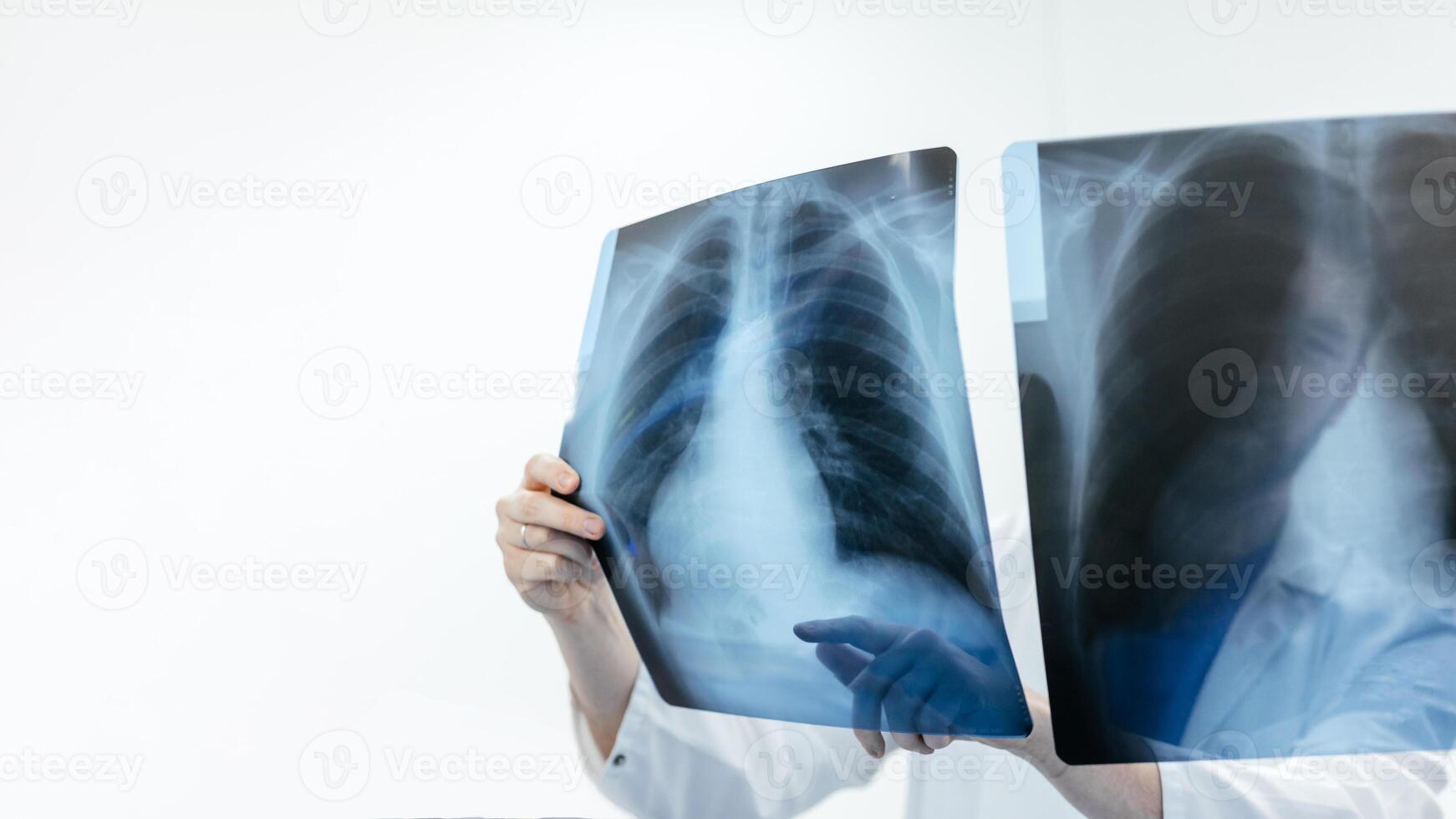 Lung disease. Radiology Doctor examining chest x-ray in clinic, closeup. Doctor shows results to patient x-ray of the lungs, smoking cigarettes problem. Medical consultation concept. Free copy space photo