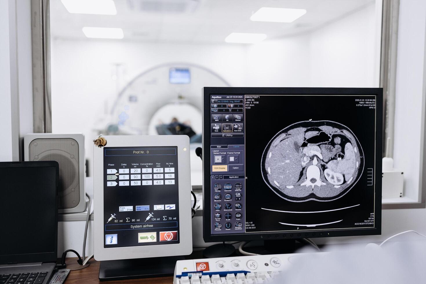Doctor examining X-ray images on display in MRI control room while in background nurse preparing the patient for examination test photo