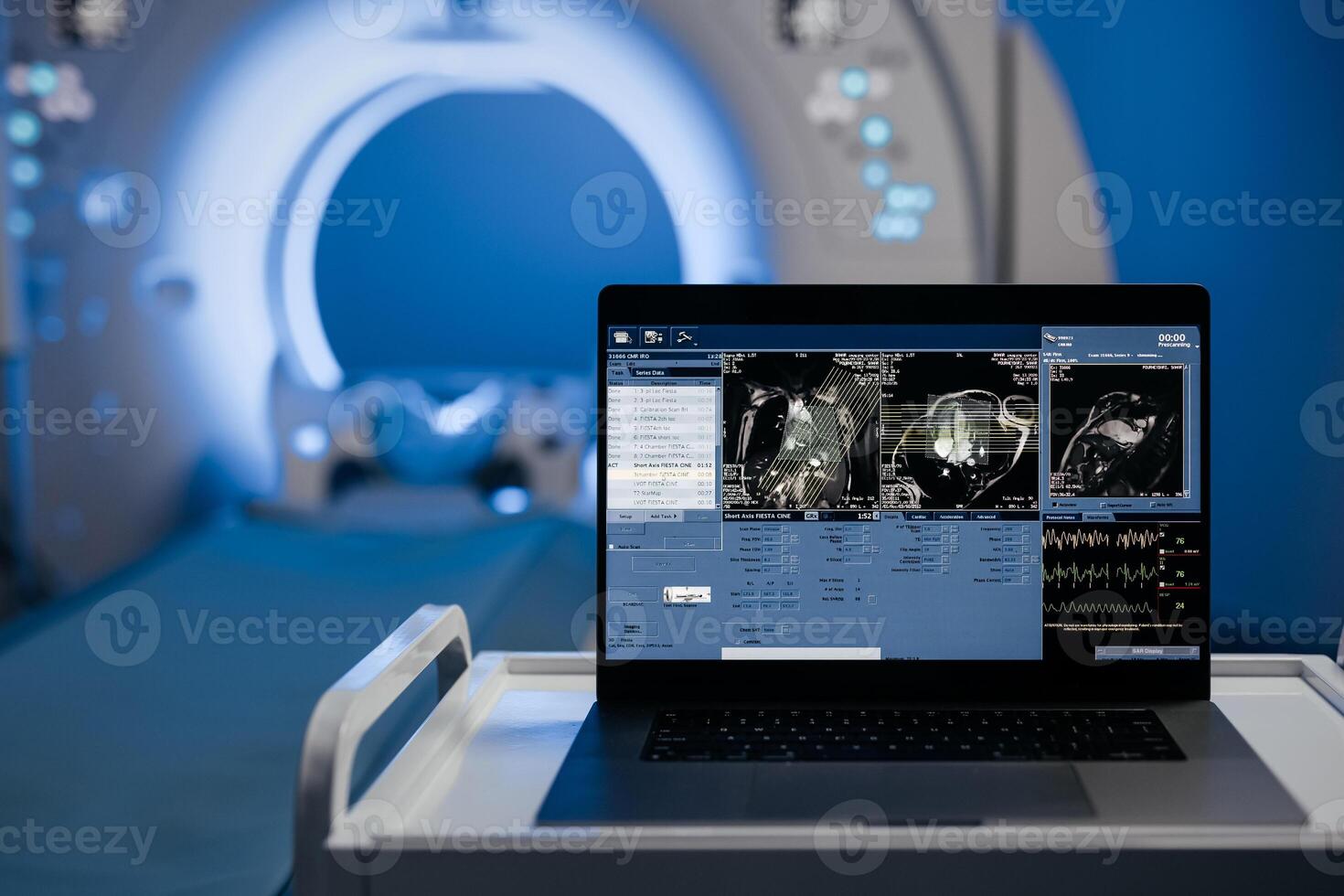 Computed tomography scan mock-up with multiple windows and data. Medical research environment software with CT scan results for computer displays and laptop screens. Banner, advertising medicine photo