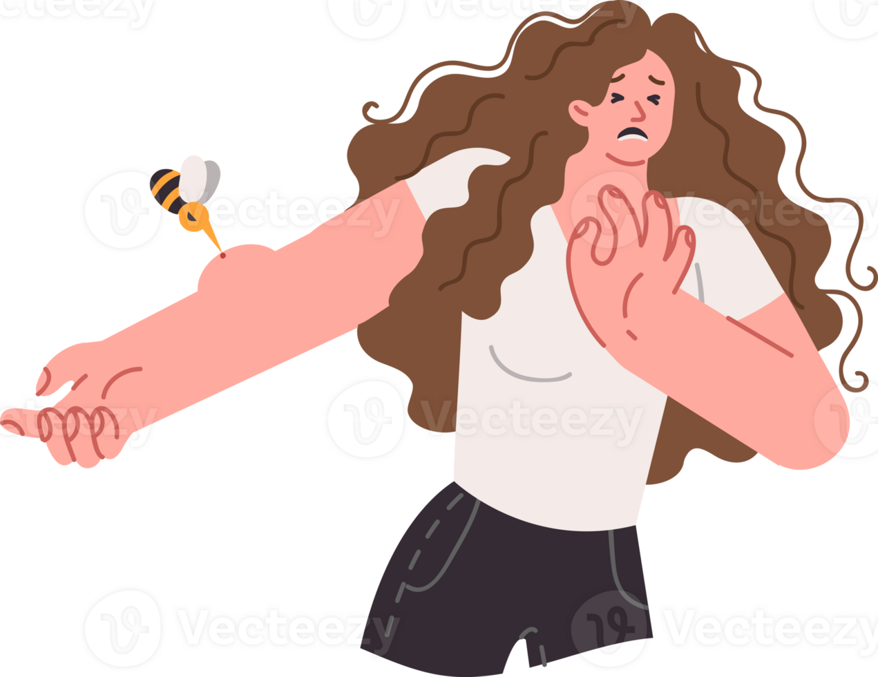 Bee bites woman hand, digging its stinger into skin and injecting venom into allergic reaction. Frightened girl panics and feels pain when stung by bee flying out of apiary or wild bumblebee png